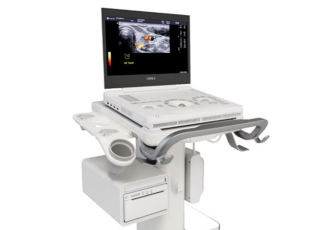 超音波診断装置